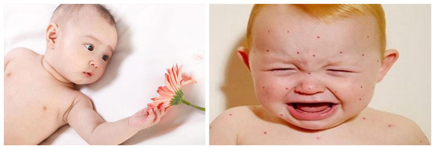 儿童湿疹反反复复，您有在家安装家用除湿产品吗？